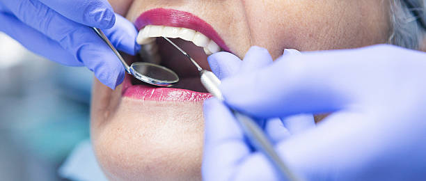 Best Dentist for Tooth Abscess  in Vail, AZ